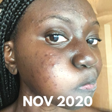 Load image into Gallery viewer, Facial Black Soap 4oz